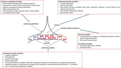 How and to What Extent Immunological Responses to SARS-CoV-2 Shape Pulmonary Function in COVID-19 Patients